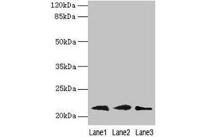 Western blot All lanes: RAP1B antibody at 0. (RAP1B anticorps  (AA 1-181))