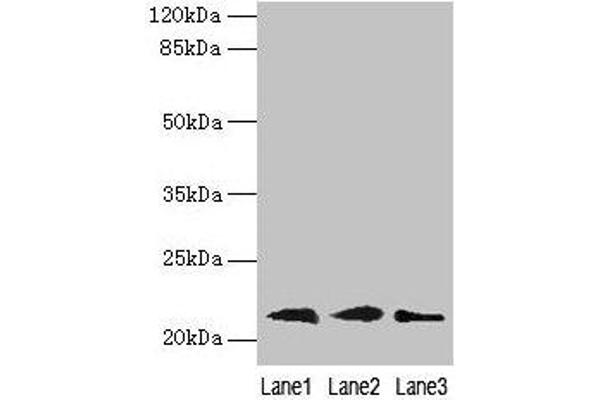 RAP1B anticorps  (AA 1-181)