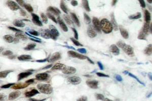 Image no. 1 for anti-Retinoblastoma 1 (RB1) antibody (ABIN271801) (Retinoblastoma 1 anticorps)