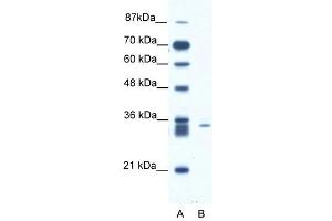 SIAH1 antibody (20R-1085) used at 0.
