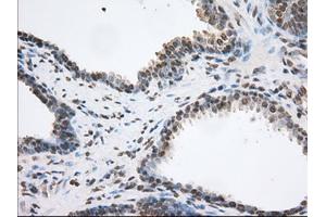 Image no. 3 for anti-Transforming, Acidic Coiled-Coil Containing Protein 3 (TACC3) antibody (ABIN1498097) (TACC3 anticorps)