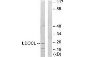 Western blot analysis of extracts from COLO205 cells, using LDOC1L Antibody. (LDOC1L anticorps  (AA 141-190))