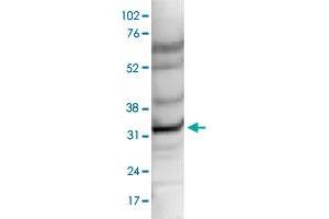 Nuclear extracts of HeLa cells (40 ug) were analysed by Western blot using CCDC101 polyclonal antibody  diluted 1 : 1,000 in TBS-Tween containing 5% skimmed milk. (SGF29 anticorps)