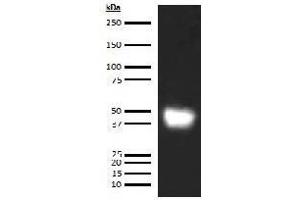 Western Blotting (WB) image for anti-Leucine-Rich alpha-2 Glycoprotein 1 (LRG1) antibody (Biotin) (ABIN5567234)