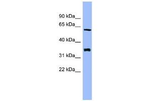 WB Suggested Anti-HECA Antibody Titration: 0. (HECA anticorps  (Middle Region))
