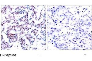 Image no. 1 for anti-Jun B Proto-Oncogene (JUNB) (pSer259) antibody (ABIN196659) (JunB anticorps  (pSer259))