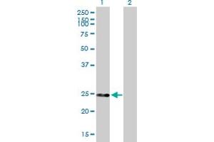 Western Blot analysis of DGCR6 expression in transfected 293T cell line by DGCR6 MaxPab polyclonal antibody. (DGCR6 anticorps  (AA 1-220))