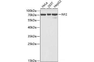 Western blot analysis of extracts of various cell lines using NF2 Polyclonal Antibody at dilution of 1:1000.
