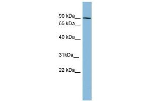 PRKCB1 antibody used at 1 ug/ml to detect target protein. (Pkc beta 1 anticorps  (N-Term))