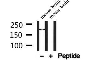 Western blot analysis of extracts from mouse brain, using TRPM2 Antibody. (TRPM2 anticorps  (C-Term))