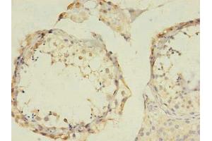 Immunohistochemistry of paraffin-embedded human testis tissue using ABIN7153493 at dilution of 1:100 (GABRB2 anticorps  (AA 26-244))