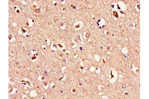Immunohistochemistry of paraffin-embedded human brain tissue using ABIN7159976 at dilution of 1:100 (ERK2 anticorps  (AA 133-316))