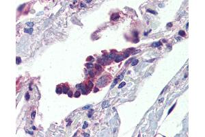 Anti-PLUNC antibody IHC of human lung, respiratory epithelium. (BPIFA1 anticorps  (AA 101-150))
