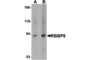 Western blot analysis of RBBP8 in mouse spleen tissue lysate with RBBP8 antibody at (A) 1 and (B) 2 μg/ml. (Retinoblastoma Binding Protein 8 anticorps  (Center))