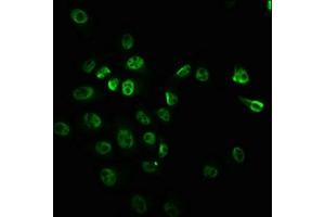 Immunofluorescence staining of Hela cells with ABIN7127714 at 1:100,counter-stained with DAPI. (Recombinant MTOR anticorps  (pSer2448))