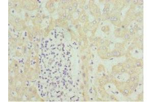 Immunohistochemistry of paraffin-embedded human liver tissue using ABIN7155995 at dilution of 1:100 (HMGCL anticorps  (AA 1-325))