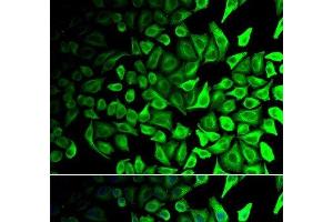 Immunofluorescence analysis of HeLa cells using DPP7 Polyclonal Antibody (DPP7 anticorps)