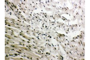 Immunohistochemistry (Paraffin-embedded Sections) (IHC (p)) image for anti-Nuclear Receptor Subfamily 3, Group C, Member 1 (Glucocorticoid Receptor) (NR3C1) (AA 20-199) antibody (ABIN3043371)