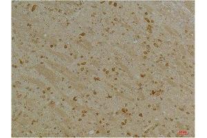 Immunohistochemical analysis of paraffin-embedded Mouse BrainTissue using Kv10. (KCNH5 anticorps)