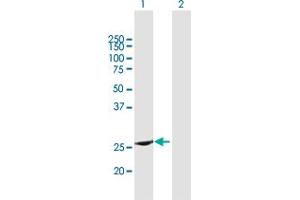 Western Blot analysis of RAB37 expression in transfected 293T cell line by RAB37 MaxPab polyclonal antibody. (RAB37 anticorps  (AA 1-223))