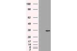 HEK293T cells were transfected with the pCMV6-ENTRY control (Left lane) or pCMV6-ENTRY CDX2 (Right lane) cDNA for 48 hrs and lysed.
