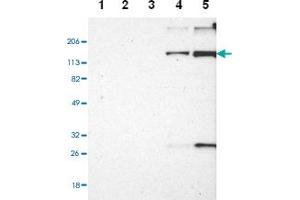 Western blot anyalysis of Lane 1: Human cell line RT-4, Lane 2: Human cell line U-251MG sp, Lane 3: Human cell line A-431, Lane 4: Human liver tissue, Lane 5: Human tonsil tissue with EMILIN1 polyclonal antibody . (Emilin1 anticorps)
