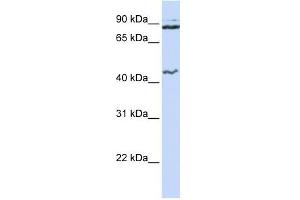 MCM9 antibody used at 1 ug/ml to detect target protein. (MCM9 anticorps  (N-Term))