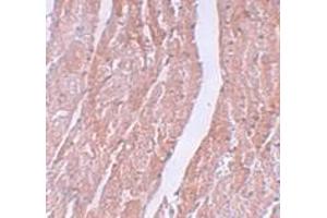 Immunohistochemistry (IHC) image for anti-MYC Induced Nuclear Antigen (MINA) (N-Term) antibody (ABIN1031457) (MINA anticorps  (N-Term))