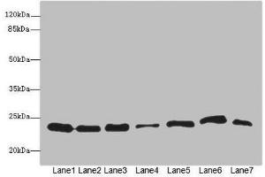 Western blot All lanes: PSMB3 antibody at 3. (PSMB3 anticorps  (AA 1-205))