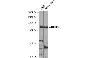 Western blot analysis of extracts of various cell lines, using NPHP3 antibody (ABIN6132967, ABIN6144770, ABIN6144771 and ABIN6224683) at 1:1000 dilution. (NPHP3 anticorps  (AA 1-130))