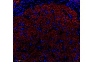 Immunofluorescence of paraffin embedded rat ovary using HSP60 (ABIN7074167) at dilution of 1: 1500 (300x lens)