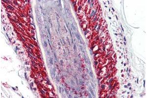 Skin, hair follicle, Human: Formalin-Fixed, Paraffin-Embedded (FFPE) (PRKD3 anticorps  (Internal Region))
