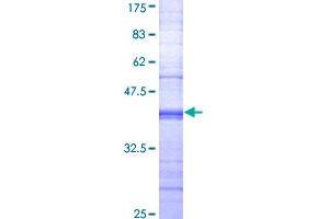 Image no. 1 for Fc Fragment of IgG, Low Affinity IIa, Receptor (CD32) (FCGR2A) (AA 46-150) protein (GST tag) (ABIN1353897)