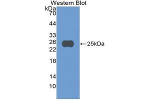 Western blot analysis of the recombinant protein. (CASP5 anticorps  (AA 145-327))