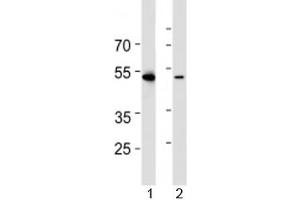Western blot analysis of lysate from 1) HL-60 and 2) Jurkat cell line using RUNX3 antibody at 1:1000. (RUNX3 anticorps  (AA 168-197))