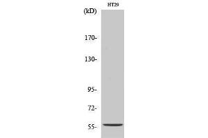 Western Blotting (WB) image for anti-Cytochrome P450, Family 2, Subfamily B, Polypeptide 6 (CYP2B6) (Internal Region) antibody (ABIN3184176)