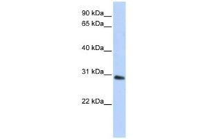 BPGM antibody used at 1 ug/ml to detect target protein. (BPGM anticorps  (C-Term))