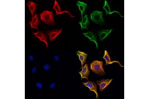 ABIN6264578 and ABIN6272979 staining Hela cells by IF/ICC. (RAB3D anticorps  (Internal Region))