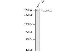 Western blot analysis of extracts of Rat brain, using SP antibody (ABIN7270512) at 1:1000 dilution. (SPARCL1 anticorps  (AA 17-300))