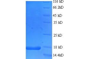 SDS-PAGE (SDS) image for Frataxin (FXN) (AA 78-207) protein (His-SUMO Tag) (ABIN5709541) (Frataxin Protein (FXN) (AA 78-207) (His-SUMO Tag))