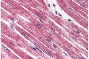 Anti-Endothelin A Receptor antibody  ABIN1048554 IHC staining of human heart.