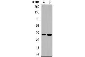 Western blot analysis of DNAJB2 expression in HEK293T (A), PC12 (B) whole cell lysates. (DNAJB2 anticorps  (C-Term))