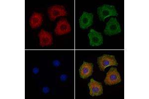 ABIN6263471 and ABIN6278039 staining Hela cells by IF/ICC.