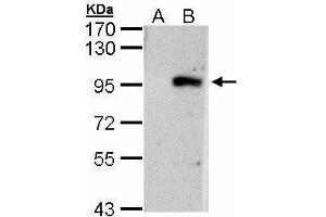 WB Image Western Blot analysis of ECEL1 expression in transfected 293T cell line by ECEL1 polyclonal antibody. (ECEL1 anticorps)