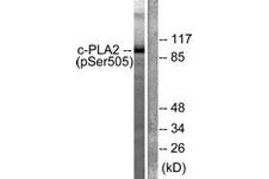 Western blot analysis of extracts from HeLa cells treated with TNF-a 20ng/ml 30', using c-PLA2 (Phospho-Ser505) Antibody. (C-PLA2 (AA 471-520), (pSer505) anticorps)