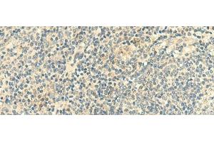 Immunohistochemistry of paraffin-embedded Human tonsil tissue using CLEC10A Polyclonal Antibody at dilution of 1:50(x200)