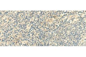 Immunohistochemistry of paraffin-embedded Human tonsil tissue using CLEC10A Polyclonal Antibody at dilution of 1:50(x200) (CLEC10A anticorps)