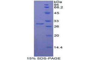 SDS-PAGE analysis of Human Mindbomb Homolog 1 Protein.