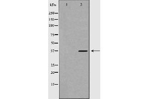 Western blot analysis of extracts of mouse brain line, using DKK3 antibody. (DKK3 anticorps)