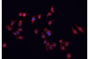 ABIN6266901 staining MCF-7 cells by IF/ICC. (FHIT anticorps  (Internal Region))
